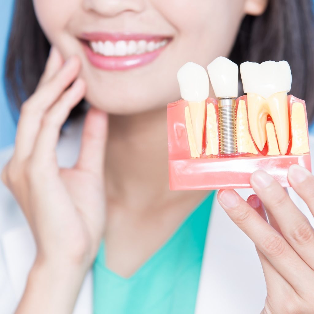A woman smiling showing implant services.