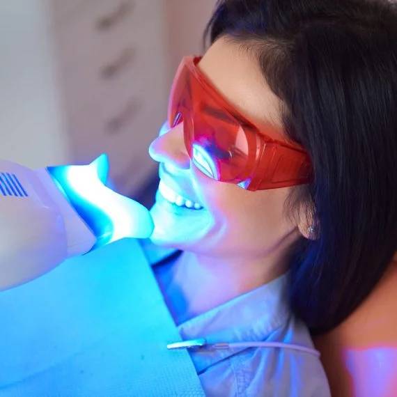 professional teeth whitening London